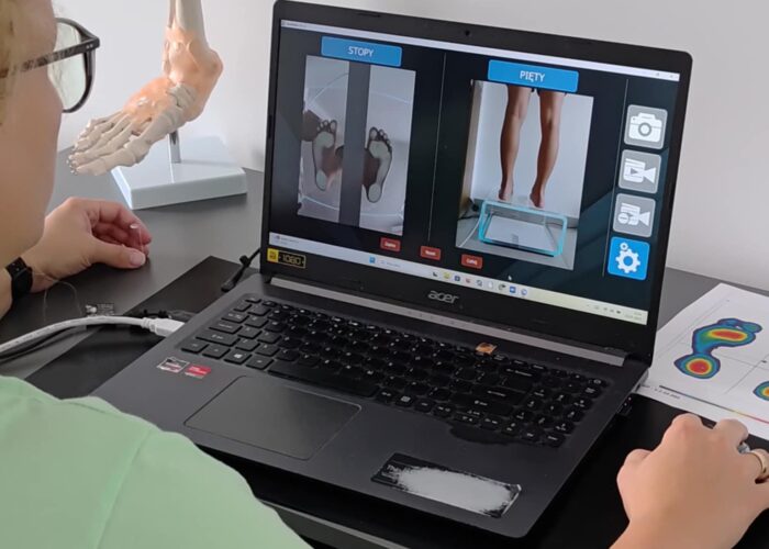 Cyfrowe badanie stóp Cyfrowe badanie stóp